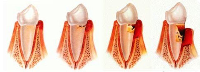 Perıodontolojı