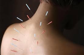 Akupunktur, akupunktur noktalarının özellikleri