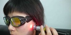 Soft laser needle tedavileri