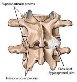 Priformis sendromu bel fıtıgı ile karıştıralabilir.