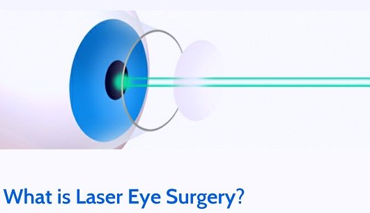 What ıs laser eye surgery?