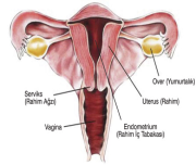 Vajina kanseri