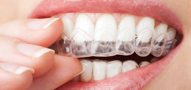 Ortodontik problemlerin oluşma nedenleri