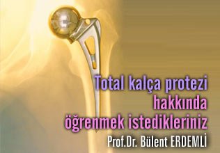 Total kalça protezi hakkında öğrenmek istedikleriniz
