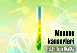 Mesane kanserleri