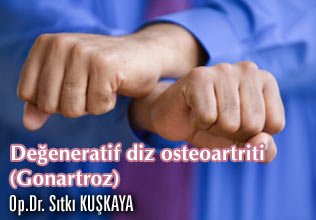 Değeneratif diz osteoartriti (gonartroz)