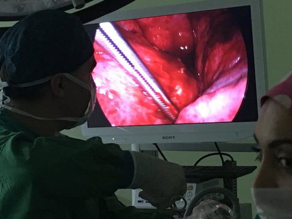 Video yardımlı torakoskopik cerrahi (vats) nedir ?