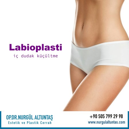 Labioplasti için uygun adaylar kimlerdir?