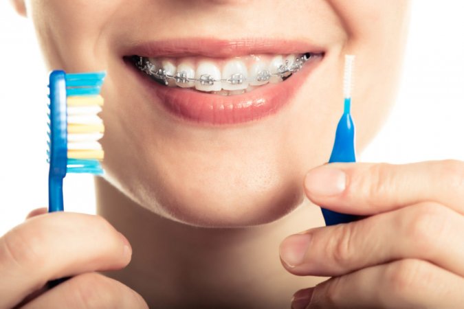 Ortodontik tedavide ağız hijyeninin önemi ve ağız bakımı