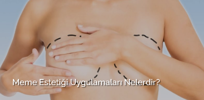 Meme estetiği uygulamaları nelerdir?