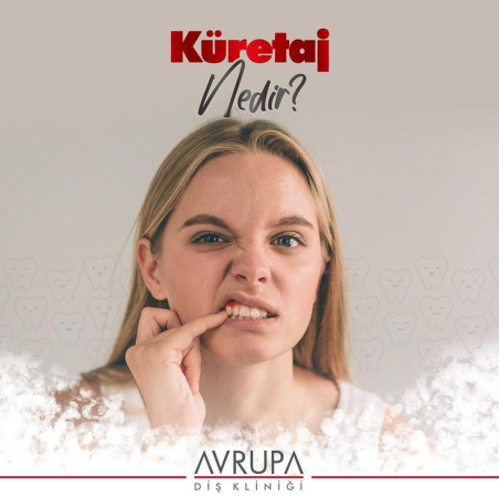 Küretaj nedir?