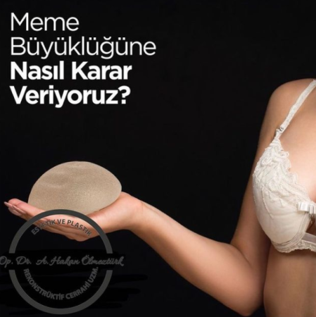 Meme estetiğinde meme büyüklüğüne karar verilirken nelere dikkat edilir?