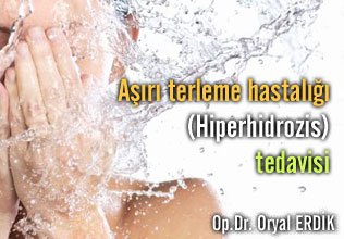 Aşırı terleme hastalığı (hiperhidrozis) tedavisi