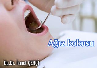 Ağız kokusu!