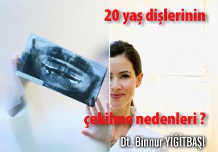 20 yaş dişlerinin çekilme nedenleri ?