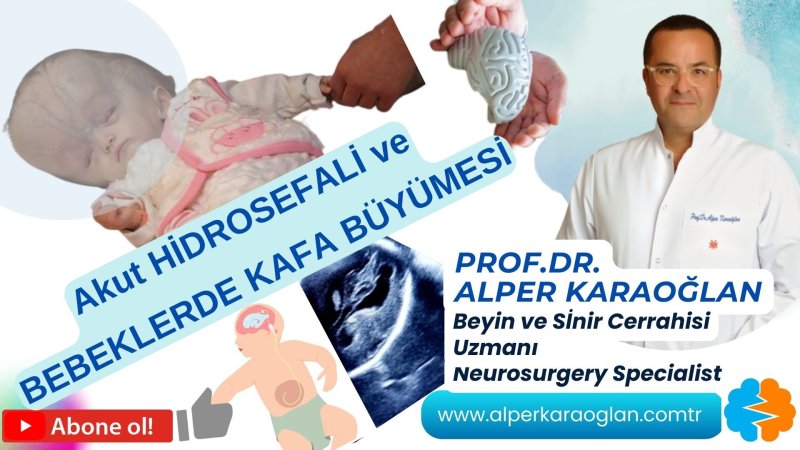 Akut hidrosefali ve bebeklerde (yenidoğanda) kafa büyümesi | prof.dr. alper karaoğlan