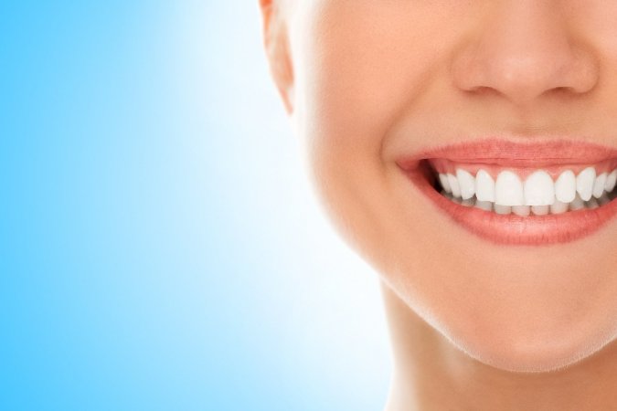 Nedir bu gülüş tasarımı ?