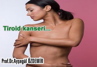 Tiroid kanseri ile meme kanseri ilişkisi