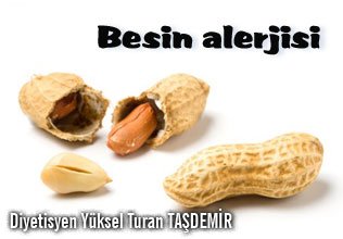 Besin alerjisi ve alerjiye neden olan besinler