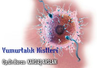 Yumurtalık (over) kisti ve cerrahi operasyon