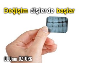 Değişim dişlerde başlar