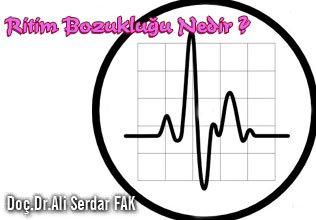 Çarpıntı ve aritmi (ritim bozukluğu ) nedir ?