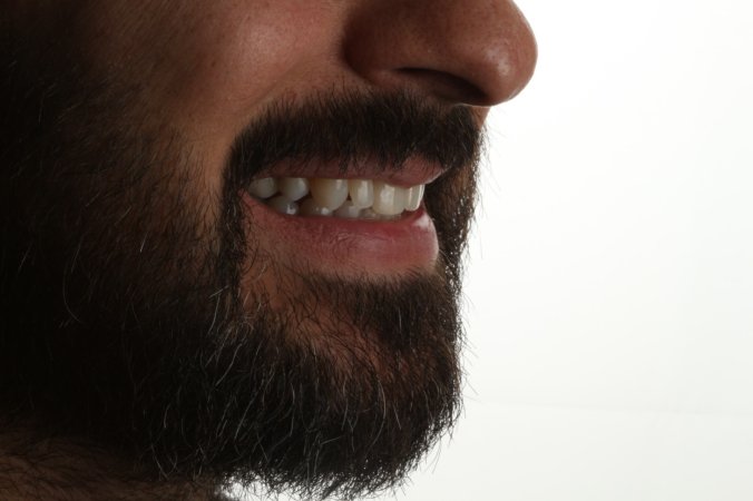 Ortodontik tedavi sırasında nelere dikkat edilmesi gerekir ?