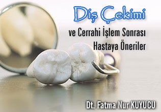 Diş çekimi ve cerrahi işlem sonrası hastaya öneriler