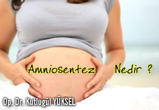 Amniosentez nedir ?