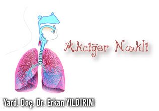 Akciğer nakli (transplantasyon)