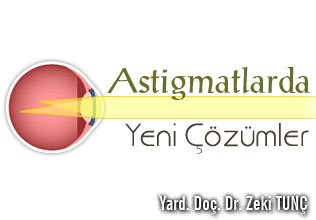 Astigmatlarda yeni çözümler