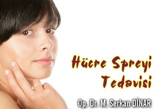 Hücre spreyi tedavisi