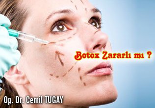 Botox zararlı mı ? , botox'tan korkmalı mıyız ?