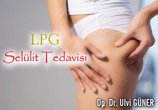 Lpg  selülit tedavisi