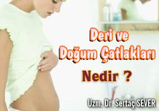 Deri ve doğum çatlakları nedir ?