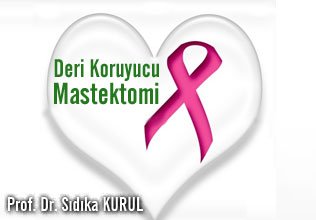 Deri koruyucu mastektomi -skin sparing mastectomy