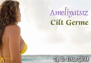 Ameliyatsız cilt germe (antilax terapi: radyofrekans-mesolifting kombinasyonu)