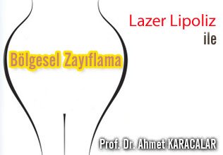 Lazer lipoliz ile bölgesel zayıflama