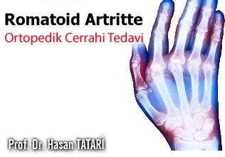 Romatoid artritte ortopedik cerrahi tedavi