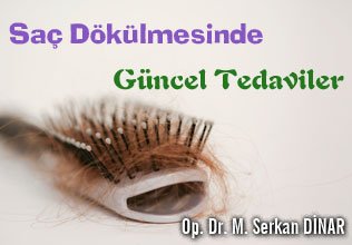 Saç dökülmesinde güncel tedaviler
