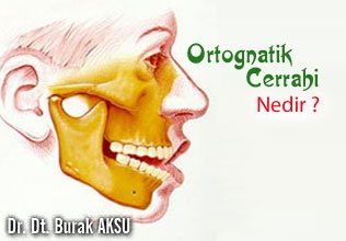 Ortognatik cerrahi nedir ?