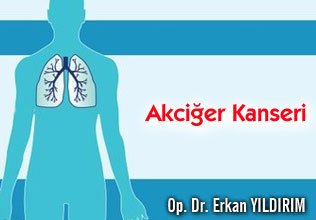 Kanser nedir? akciğer kanseri nedir?