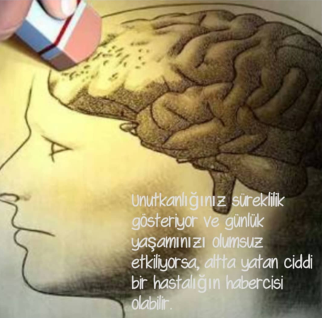 Unutkanlık
