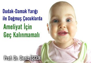 Dudak-damak yarığı ile doğmuş çocuklarda ameliyat için geç kalınmamalı