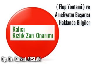 Kalıcı kızlık zarı onarımı ( flep yöntemi ) ve ameliyatın başarısı hakkında bilgiler