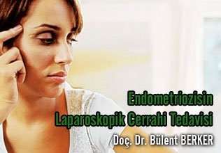 Endometriozisin laparoskopik cerrahi tedavisi