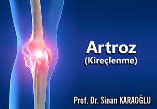 Artroz (kireçlenme) ve tedavisi