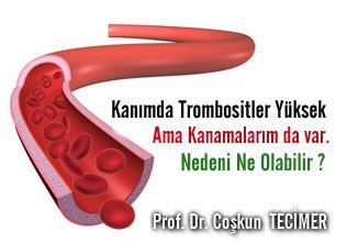 Kanımda trombositler yüksek ama kanamalarım da var. nedeni ne olabilir?