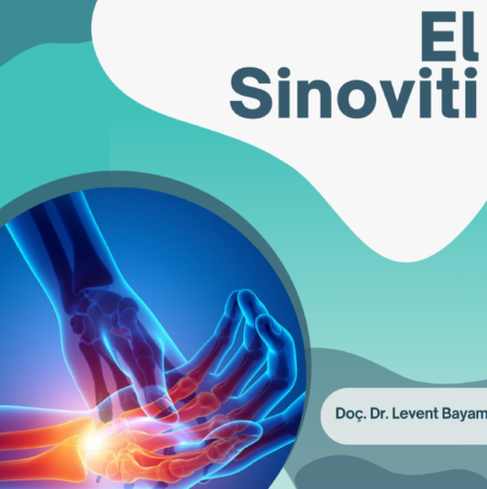 El sinoviti