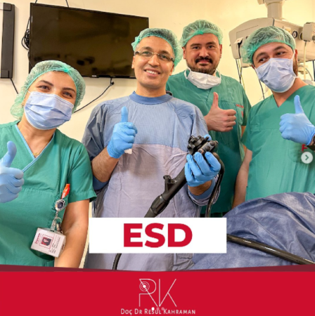 Esd nedir?